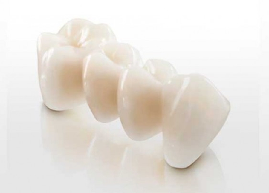 mosty zębowe protetyczne