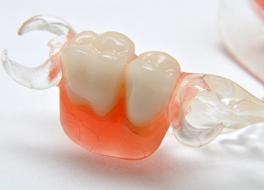 protezy zębowe elastyczne acetalowe nylonowe